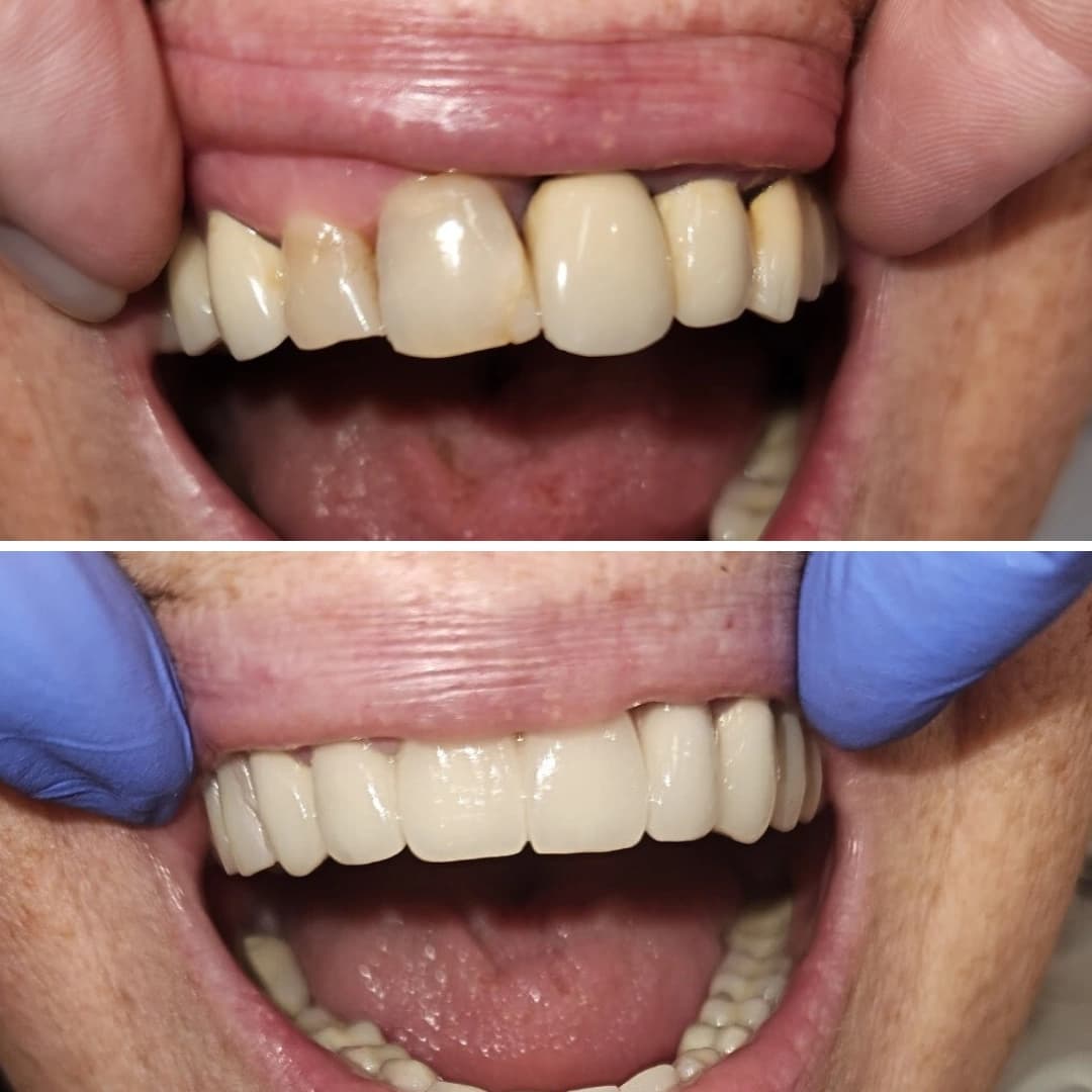 Before And After 1
