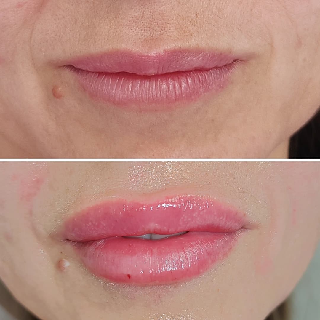 Before And After 10