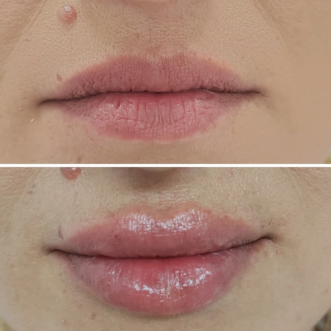 Before And After 11