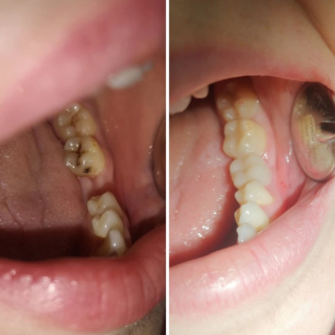 Before And After 12
