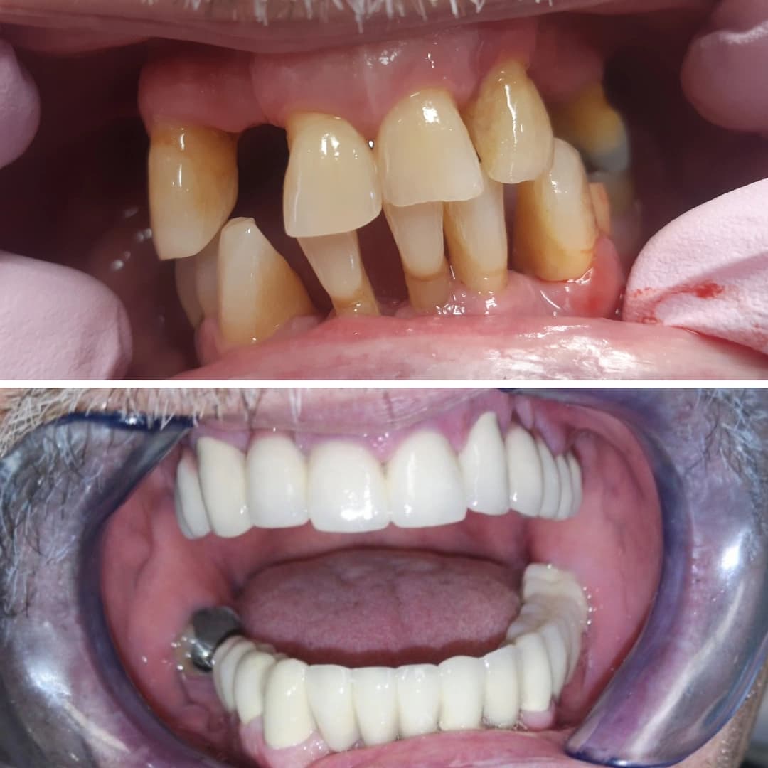 Before And After 13