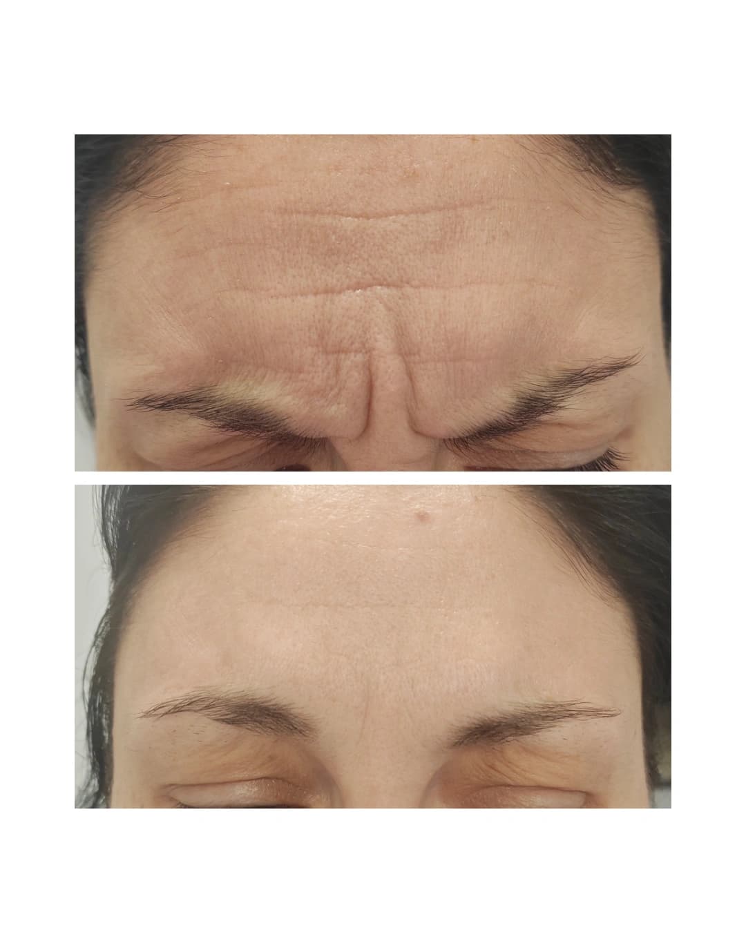Before And After 14