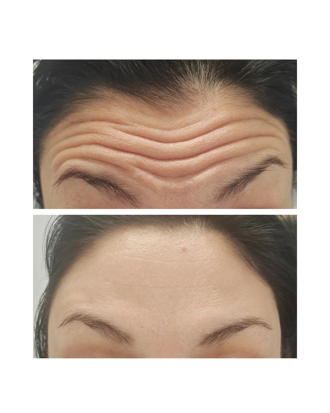 Before And After 15