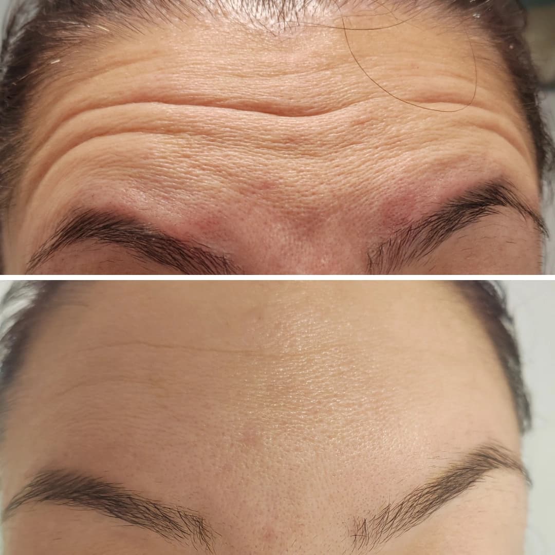 Before And After 18