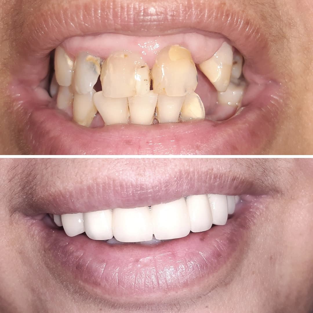 Before And After 19