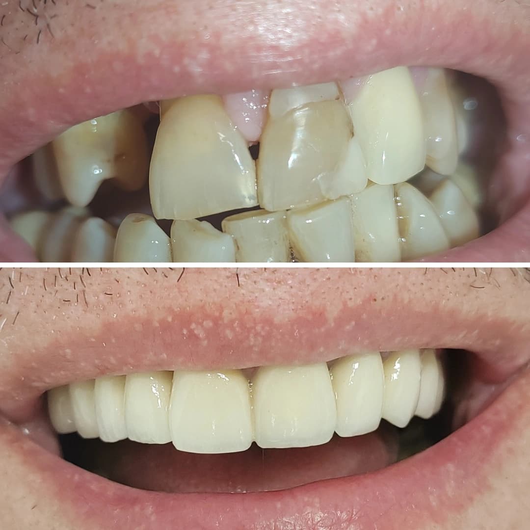 Before And After 20