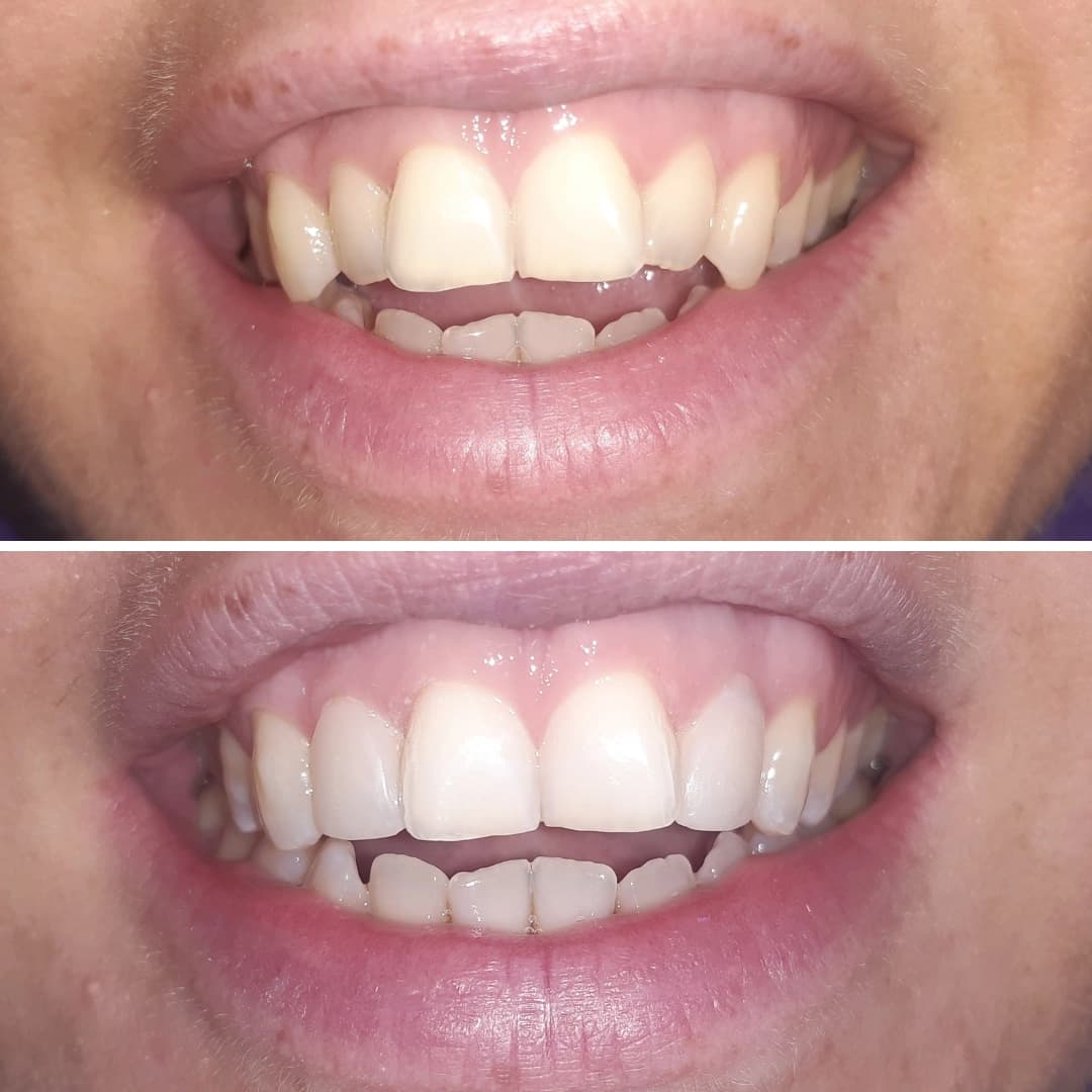 Before And After 22