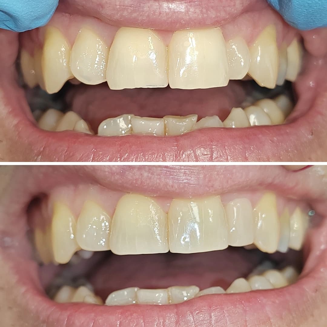 Before And After 23