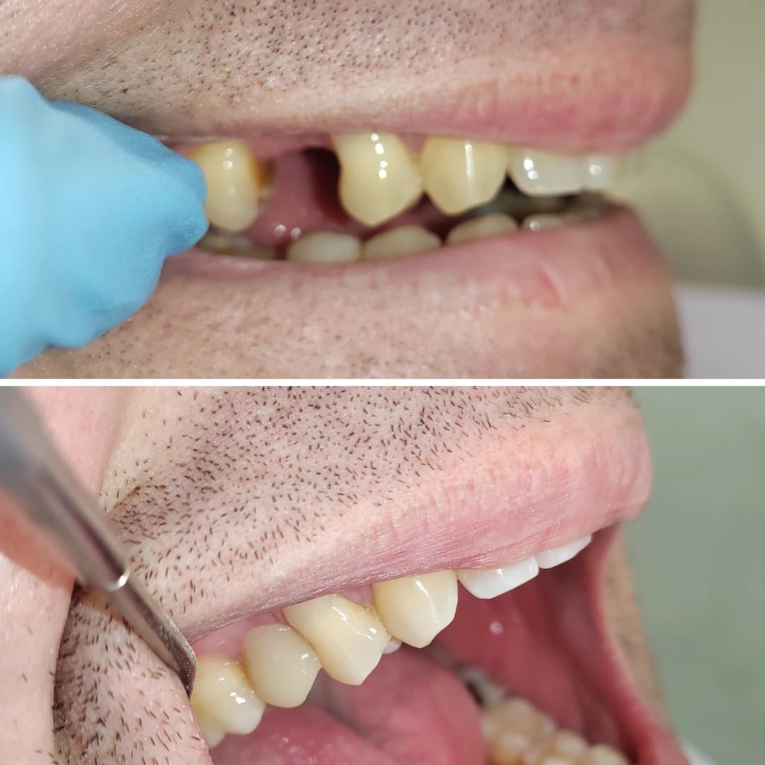 Before And After 24