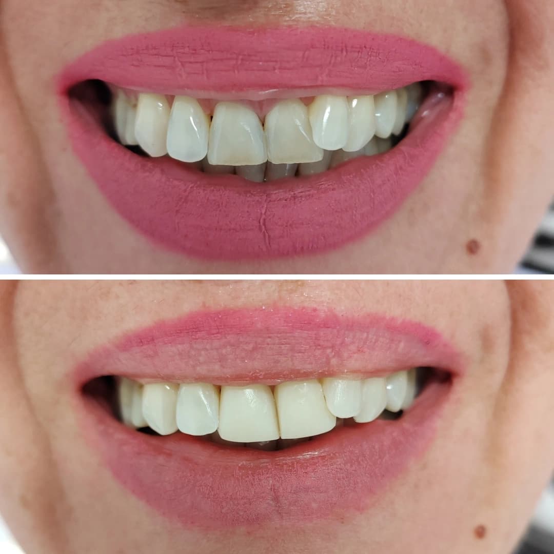 Before And After 25