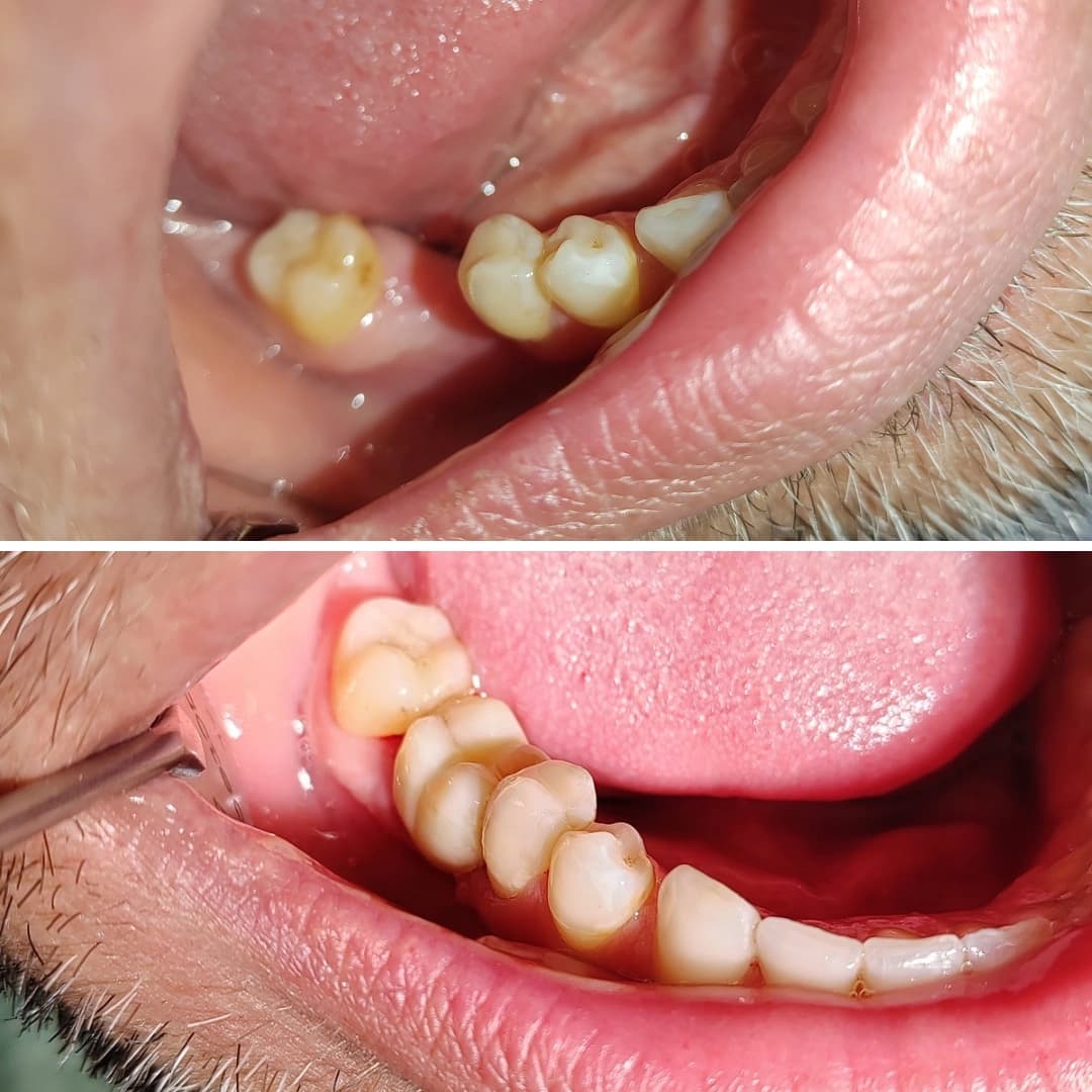 Before And After 26