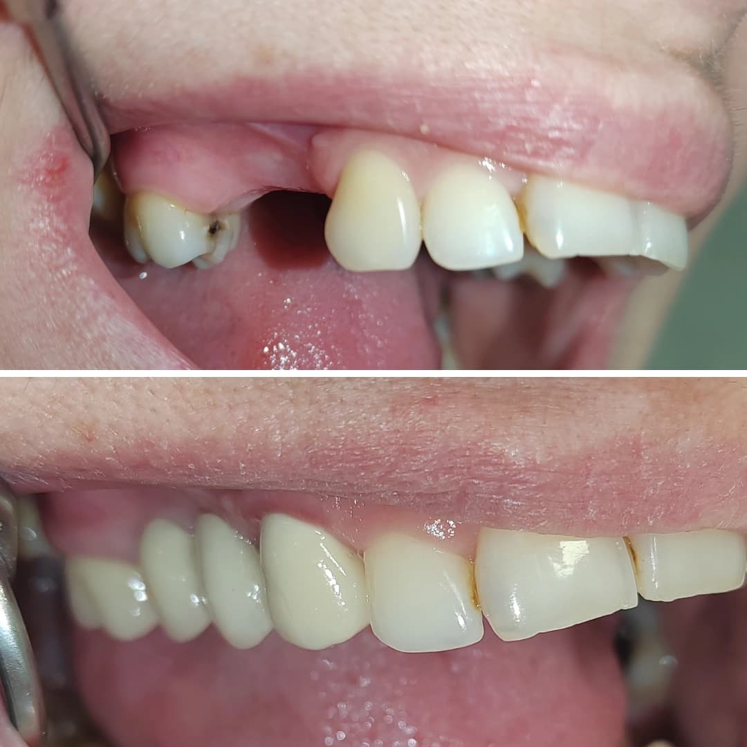 Before And After 27