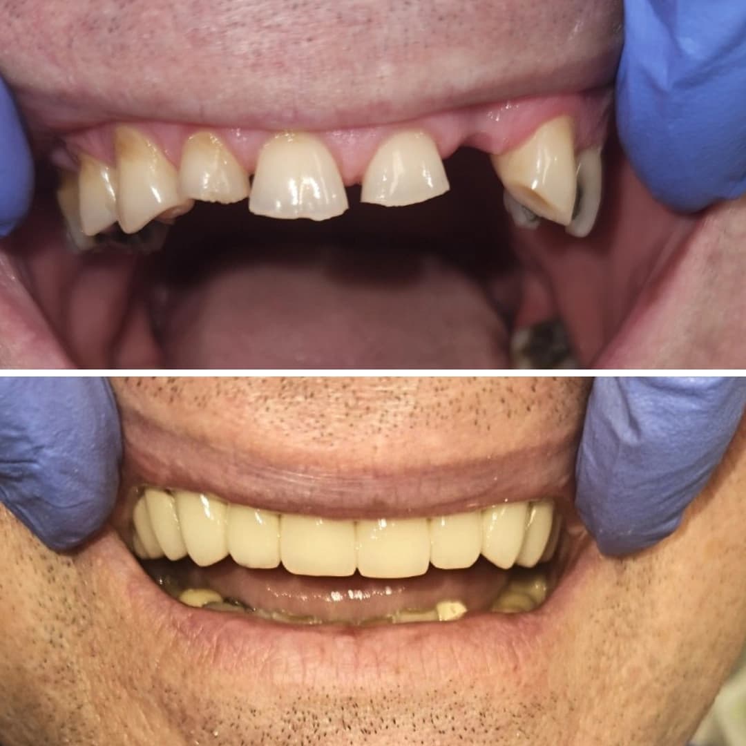 Before And After 3