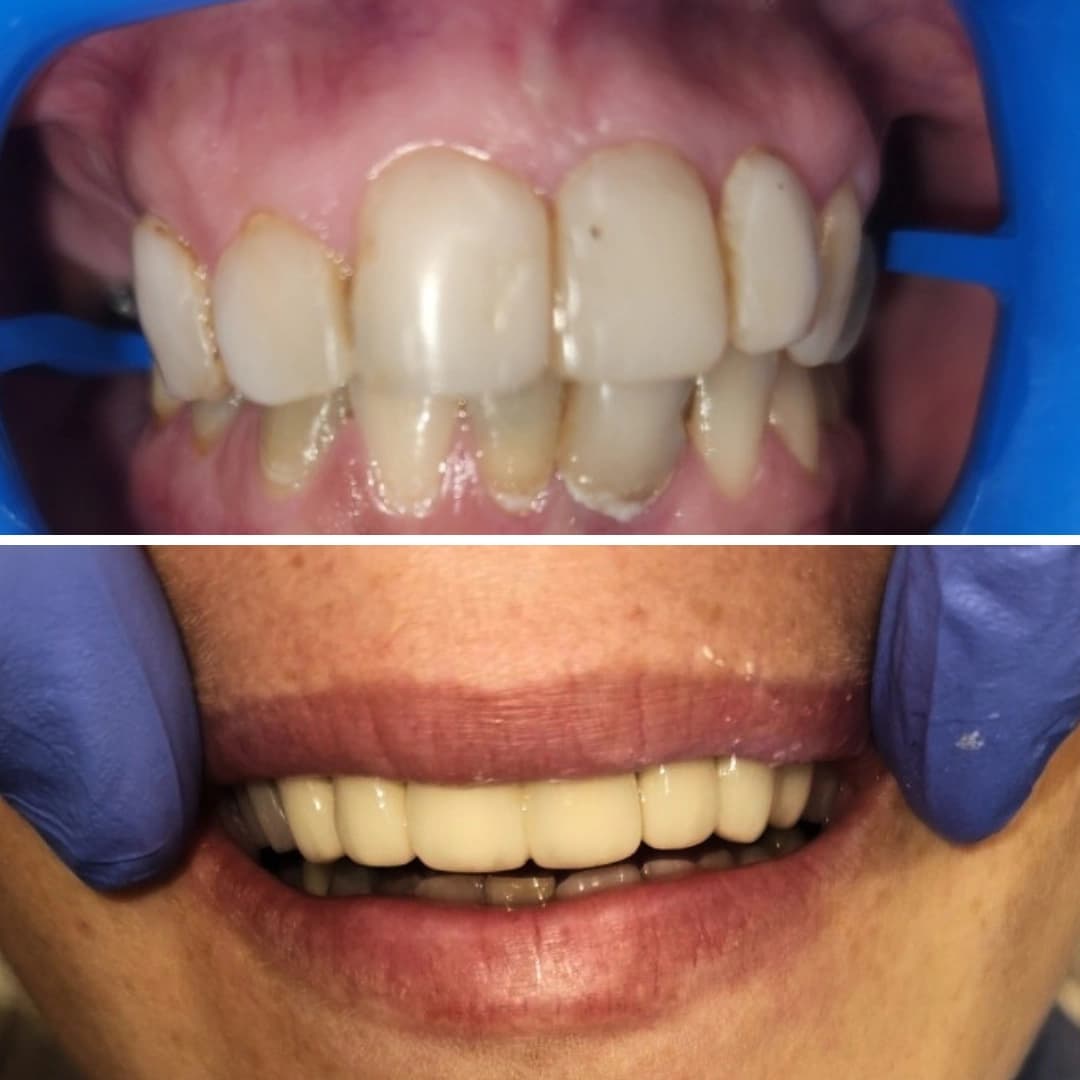 Before And After 4