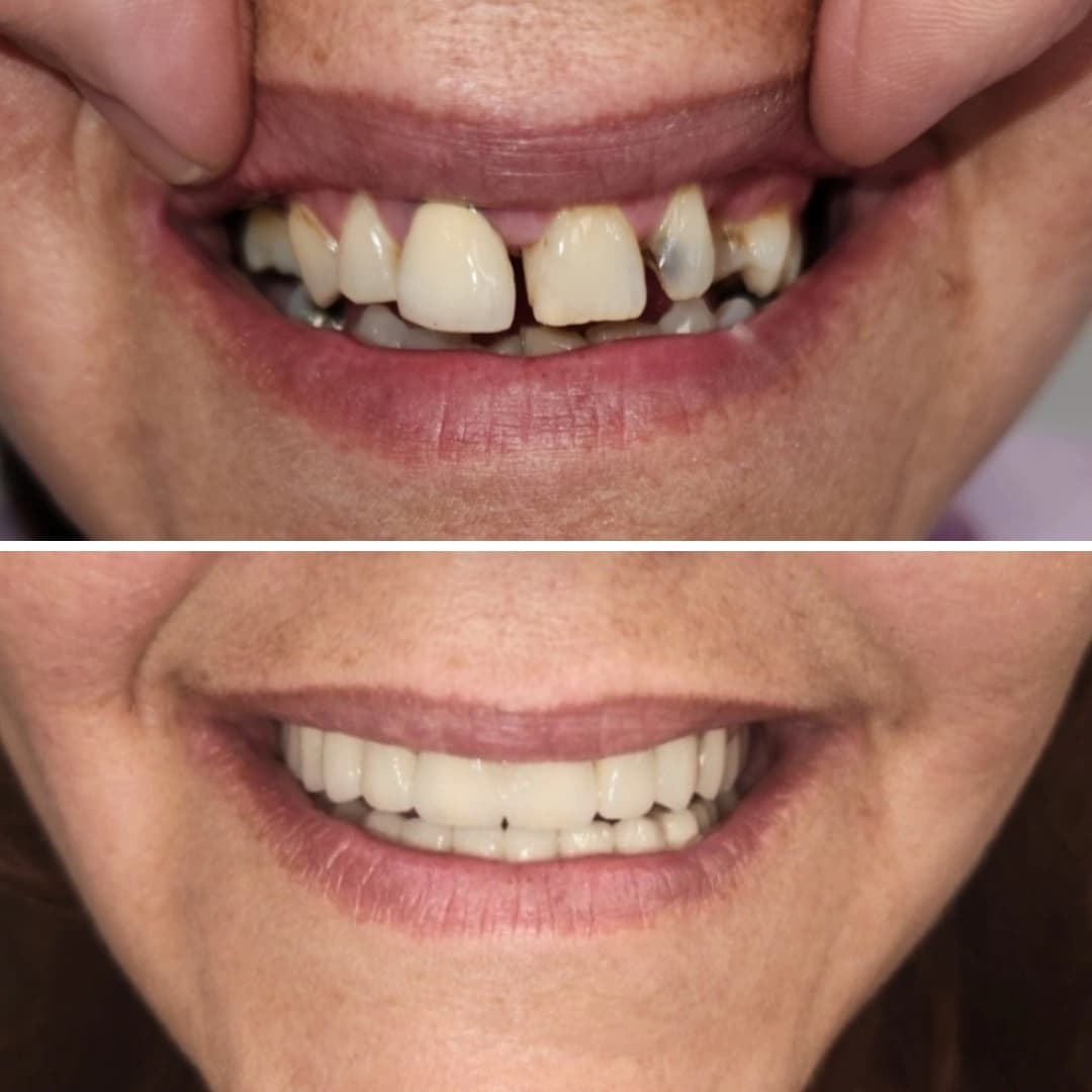 Before And After 5