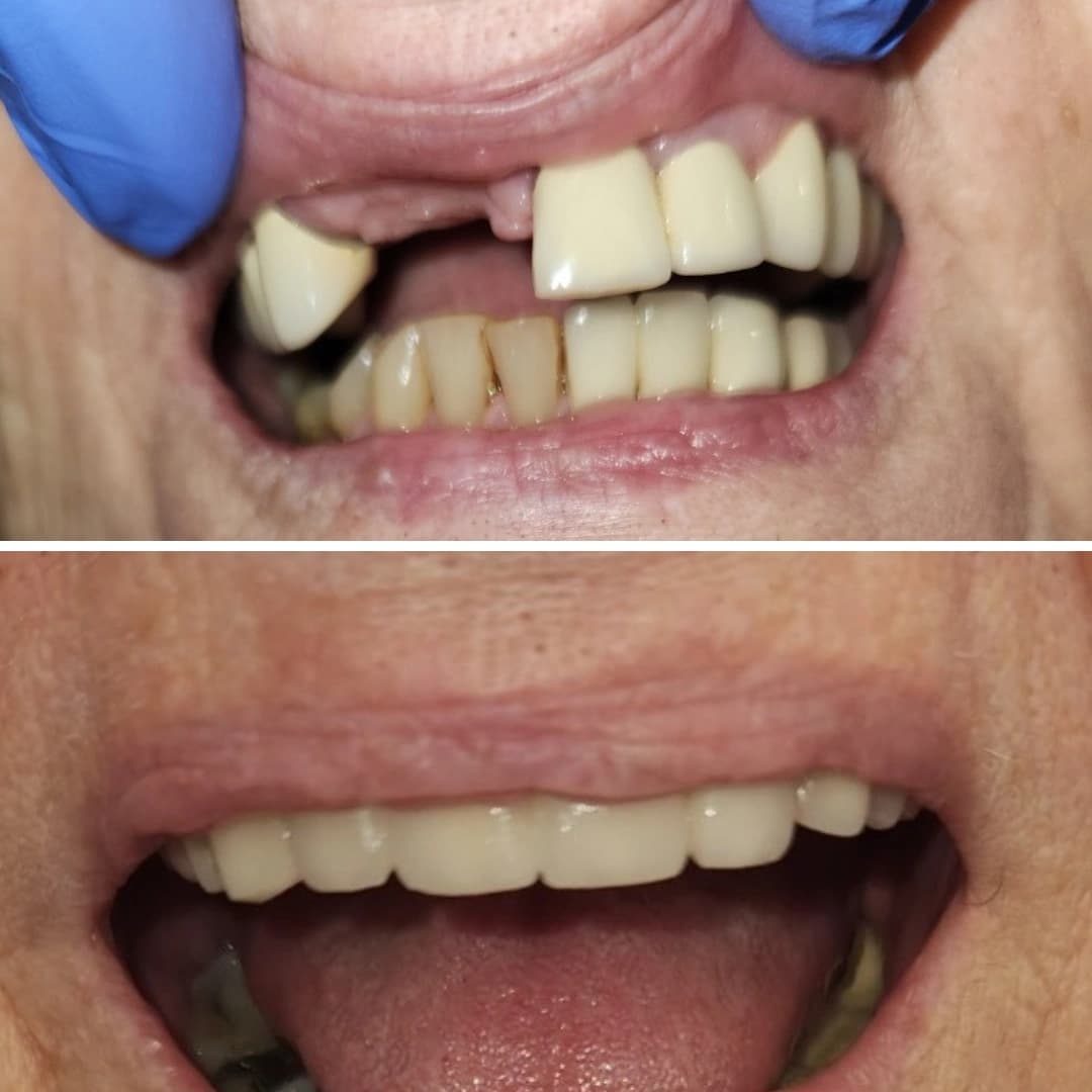 Before And After 6
