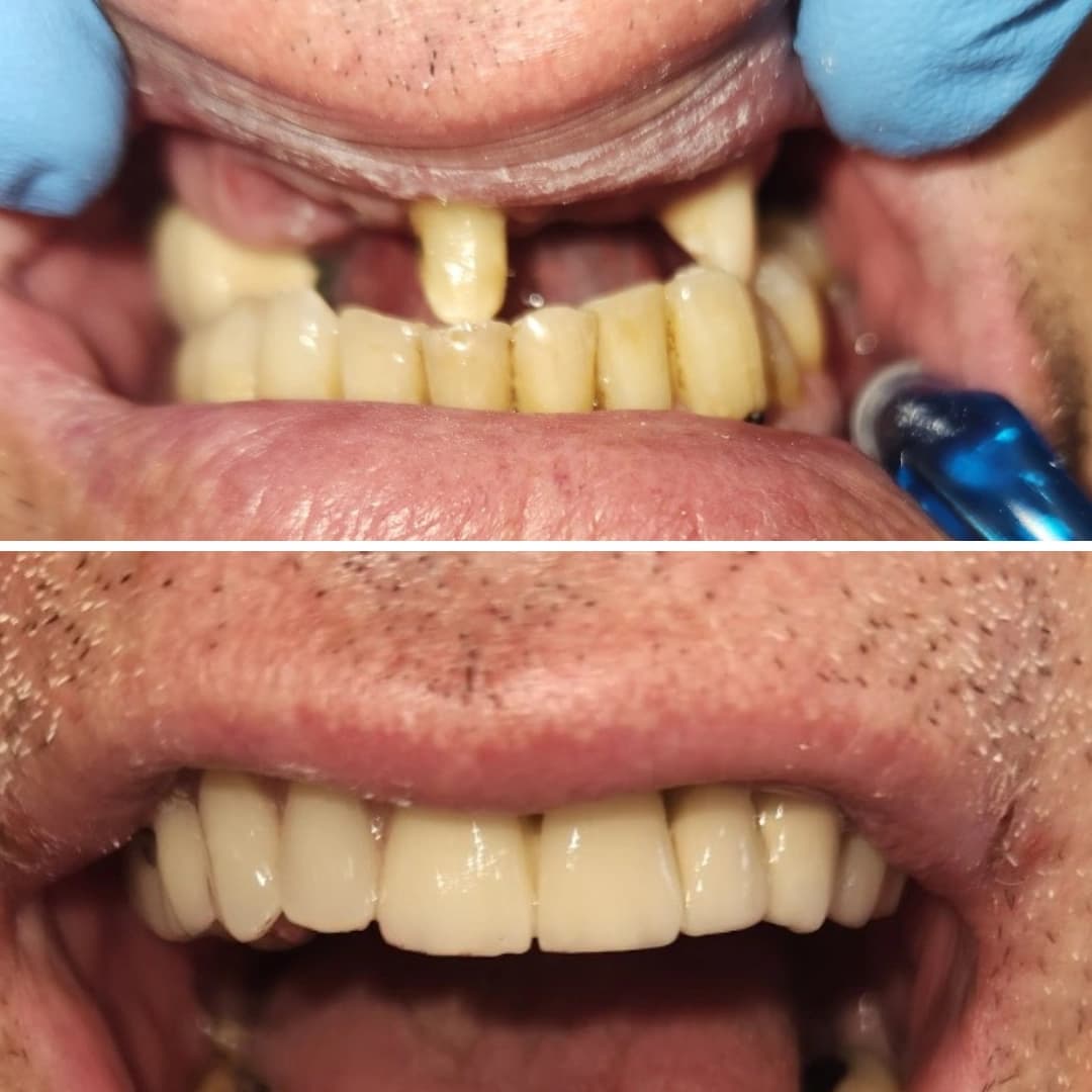 Before And After 7