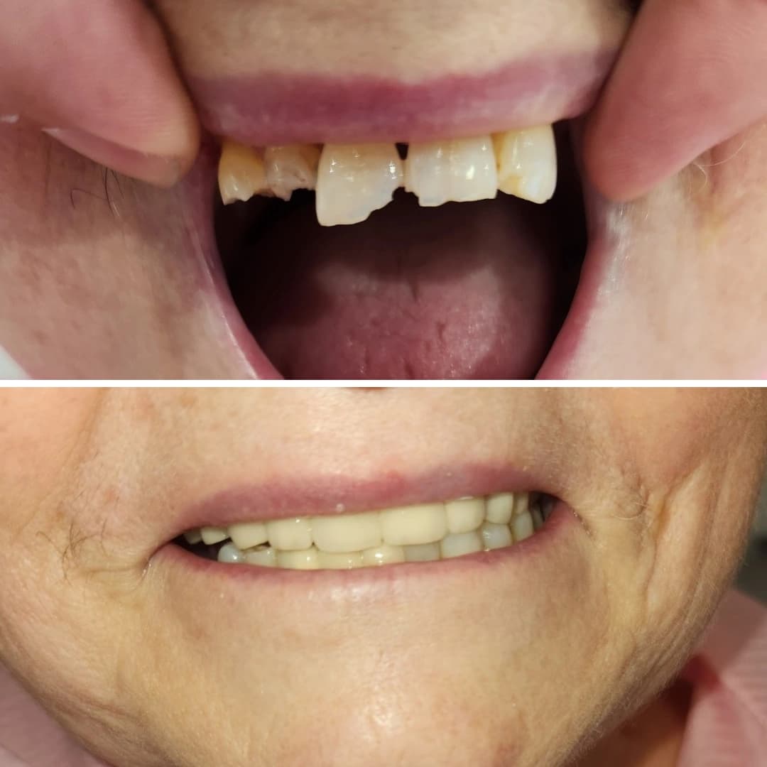 Before And After 8