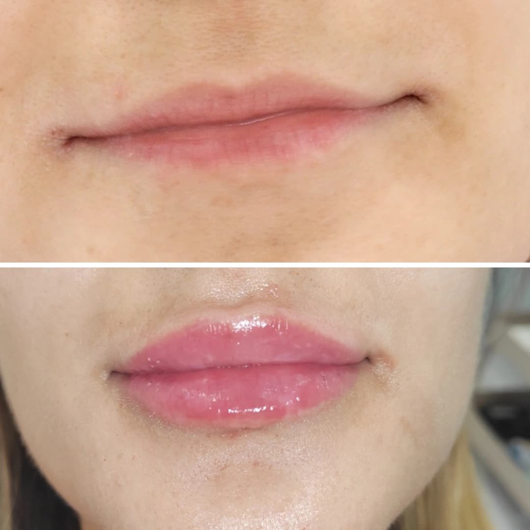 Before And After 9